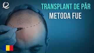 Metoda Transplant de păr FUE la Clinicana în Istanbul Turcia [upl. by Evans668]