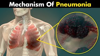 The Mechanism Of Pneumonia  3D Animation UrduHindi [upl. by Otrebtuc814]