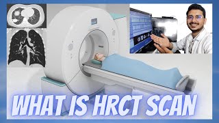 What is HRCT Scan  HRCT Chest scan explanation  एच आर सीटी स्कैन क्या होता है [upl. by Imhskal]