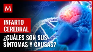 ¿Hay síntomas ¿Qué es un infarto cerebral y cuáles son sus posibles causas [upl. by Asreht137]