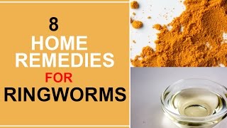 8 Home Remedies For Ringworms [upl. by Hailed]