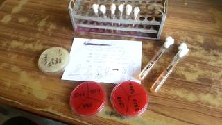 GTT Germ Tube Test Mycology [upl. by Willette615]