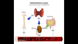 Hiperparatiroidismo [upl. by Irafat793]