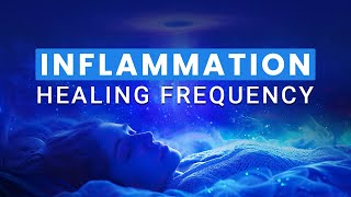 Inflammation Healing Frequency Heal Wounds amp Inflammation While Sleep [upl. by Freud]