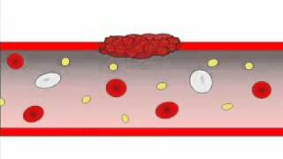 Hemostasis  Helpful Blood Clotting flv [upl. by Wolenik]