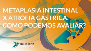 Metaplasia intestinal x atrofia gástrica Como podemos avaliar [upl. by Roos]