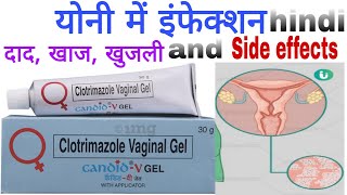 Candid v gel Canesten cream Clotrimazole vaginal cream use side effects candid v gel how to apply [upl. by Graniah40]