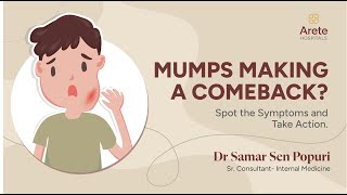 Mumps Causes Symptoms and Treatments  Dr Samar Sen P  Arete Hospitals mumps [upl. by Yblocaj]