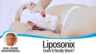 DOES IT REALLY WORK Liposonix  Non Surgical Liposuction [upl. by Erma]