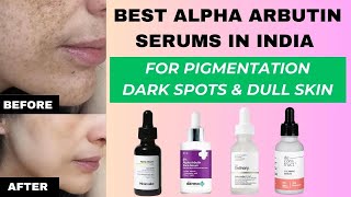 Best Alpha Arbutin serums in India Fades pigmentation Dark Spots amp melasma  HINDI [upl. by Filipe]