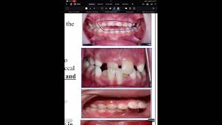 Paediatric dentistry lecture 1 part 2 [upl. by Lorak]