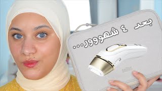 نتيجة ازالة شعر الجسم بالليزر ف البيت بعد ٤ شهور  braun ipl silk expert pro 5  after 4 months [upl. by Aldred]