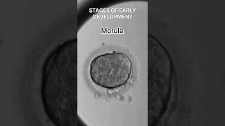 Early development of human  Cleavage  morula  blastulation [upl. by Enimajneb]