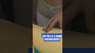 How to dry needle the fibularis longus [upl. by Ranna]