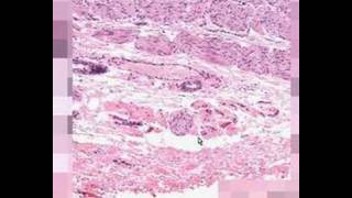 Shotgun Histology GastroEsophageal Junction [upl. by Mateya]