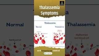 THALASSEMIA  Causes Symptoms amp Treatment Causes Symptoms treatment thalassemia [upl. by Pinebrook]