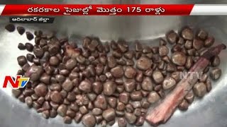 Doctors Remove 175 Kidney Stones From A Single Patient at Adilabad District  NTV [upl. by Dmitri473]