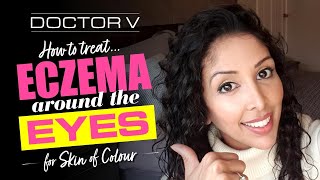 Doctor V  How To Treat Eczema around the Eyes for Skin of Colour  Black or Brown Skin [upl. by Nimrahc]