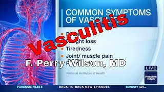 What is Vasculitis [upl. by Yodlem]