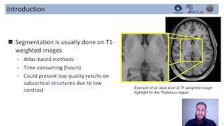 Thalamus segmentation using Deep Learning on diffusion MRI [upl. by Lapo797]