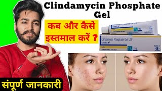 Clindamycin Gel Uses and Side Effects  Clindamycin Gel Review Clindac A Gel [upl. by Stulin809]