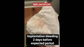 Implantation bleeding picture shorts pregnancy earlypregnancysymptoms viral [upl. by Ayotak984]