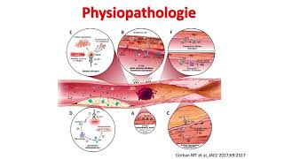 Syndrome des anticorps antiphospholipides  mise à jour  Pr P Fontana [upl. by Cannice]