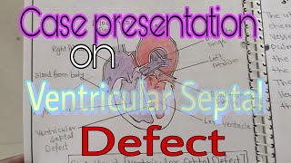 Case presentation on Ventricular Septal Defect heartdisease NCP on Ventricular Septal Defect [upl. by Mac]