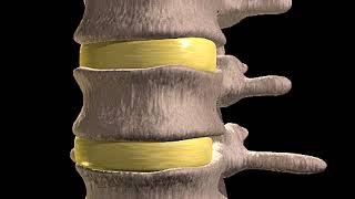 How Slipped Discs Happen Animation What’s Herniation  Herniated Nucleus Pulposus Bulging Disc Video [upl. by Decato]