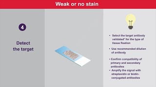 Immunohistochemistry Tips and Tricks for Weak or No Stain [upl. by Vashtia184]