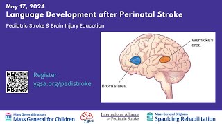 Language Development after Perinatal Stroke [upl. by Neliac]