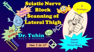 Ultrasound Scanning Principles for Supine Lateral Sacral Plexus or Sciatic Nerve Block DrTuhinM [upl. by Ijok634]