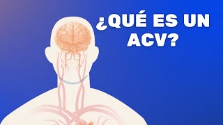 ¿Qué son los accidentes cerebrovasculares o ACV [upl. by Arly481]