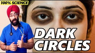 Permanently Cure DARK CIRCLES  आँखों के काले घेरे  Science  Home Remedy in HIndi  DrEducation [upl. by Hummel]