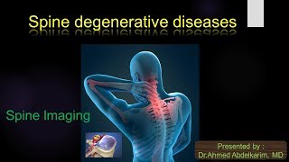 1spine degenerative diseases [upl. by Nayrbo]