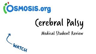 Cerebral Palsy  Clinical Review [upl. by Calysta39]