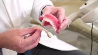 How do Invisalign braces work [upl. by Steinberg]