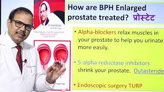 प्रोस्टेट बढ़ना  Enlarged prostate and its treatment DrProfSantosh Kumar PGI [upl. by Ori]