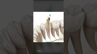 What To Expect During a Root Canal Is It Right For You [upl. by Anayit]