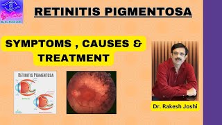 RETINITIS PIGMENTOSA  SYMPTOMS CAUSES amp TREATMENT [upl. by Aynav]