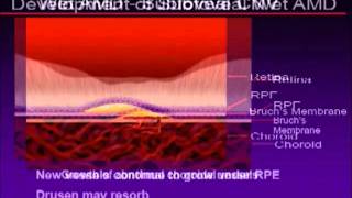 Macular Degeneration 26 A Scientific Explanation [upl. by Aisha467]