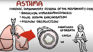 Asthma  Bronchial Asthma  Types  Causes  Pathophysiology  Hindi  Urdu  अस्थमा  Animation [upl. by Anemaj]