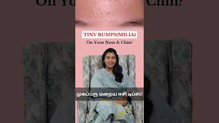 Tips to get Rid of Tiny Bumps on Your Face 😲 Skincare தமிழ் draishwaryaselvaraj skincare [upl. by Itirahc135]