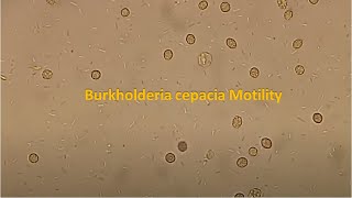 Burkholderia cepacia Motility [upl. by Martel292]