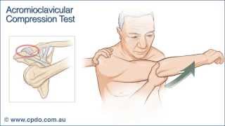 Acromioclavicular Compression Test  Chiropractic Online CE™ [upl. by Smith410]