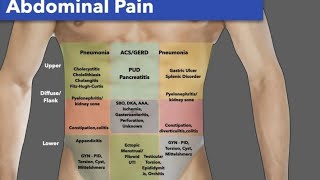 abdominal examination  فحص البطن [upl. by Dulci435]