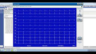 Connex Cardio ECG and Allscripts Touchworks Demo  US English [upl. by Lebasy]