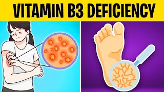 Are You Vitamin B3 Deficient Look Out for These Signs [upl. by Nolahs]