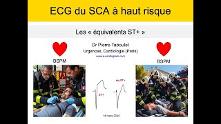 ECG du syndrome coronaire aigu Les équivalents ST à haut risque P Taboulet [upl. by Pincince779]