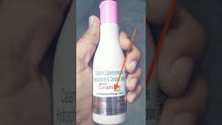 calamine lotion uses  complete allergy treatment [upl. by Deonne]